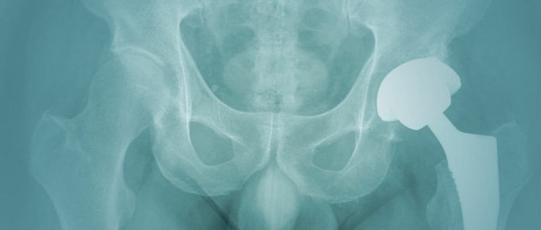 A person holds a bone near their hip, indicating a focus on anatomy or a medical context.