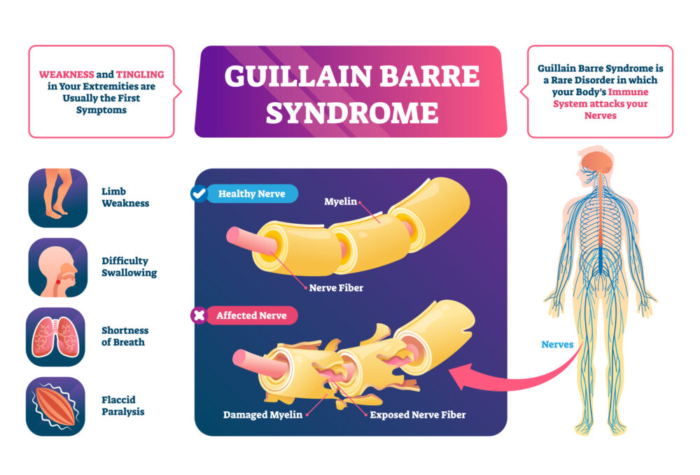 How GBS Works infographic