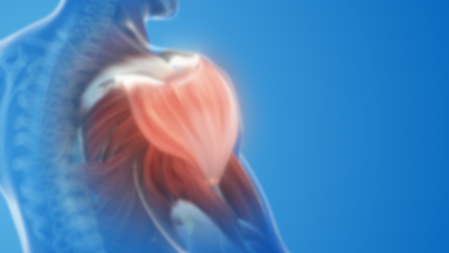 Sirva and impingement syndrome